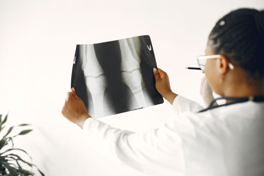 Pesquisadores estudam Cannabis medicinal como opção de tratamento da osteoartrite