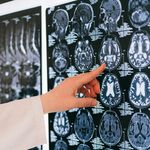 A doctor's hand points to a brain MRI scan on a lightbox, illustrating medical diagnosis.